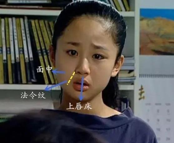 为什么有些人年纪不大，但法令纹却很重？