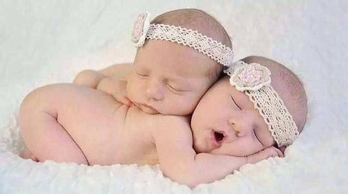 连体人一方去世,假如说有一个连体人去世了