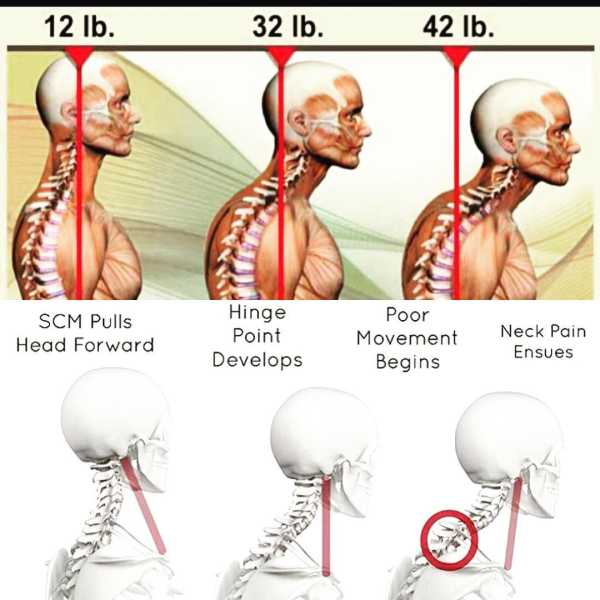 如何做好脖子的日常保健,如何做好脖子颈椎的日常运动保健