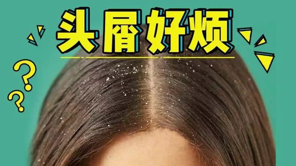 为什么经常洗头还是很多头皮屑,每天洗头为什么头皮屑还是很多