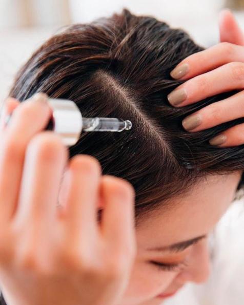 护头皮精油去头皮屑推荐,这款超好用的头皮精油必收藏