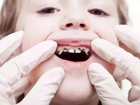 专门为小朋友设计的牙刷,儿童牙刷专为儿童宝宝设计