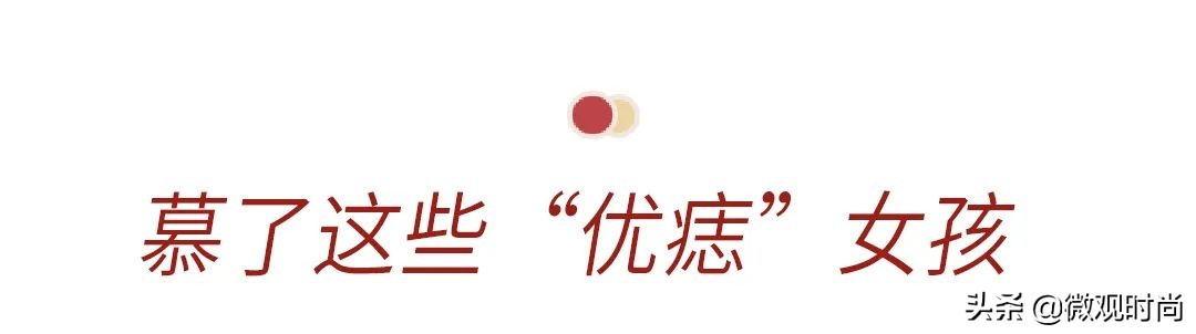 脸上有很多痣但是很好看的女生,脸上哪里有痣显好看