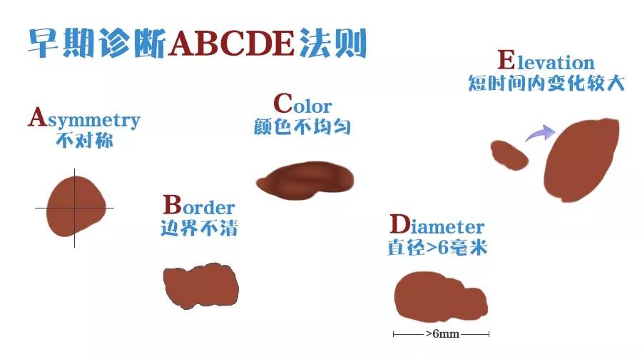小心直径大于6毫米的痣