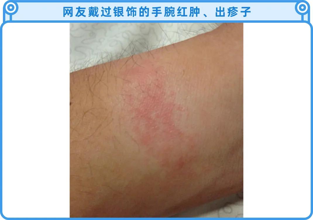 不要乱戴首饰,戴银饰要注意什么