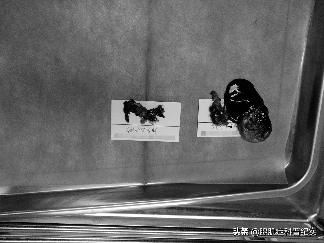 连续服用二十几颗止痛药会怎么样,连续吃7年止痛药