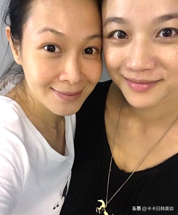 去除黑眼圈的8个超简单的方法,最有效的去除黑眼圈的方法