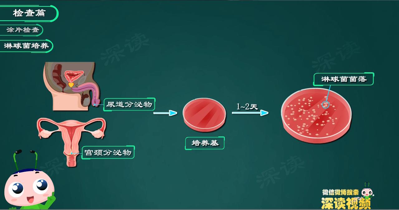 得了淋病就该死吗,得了淋病要干嘛