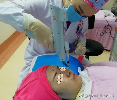 无针水光涂抹式,注射式