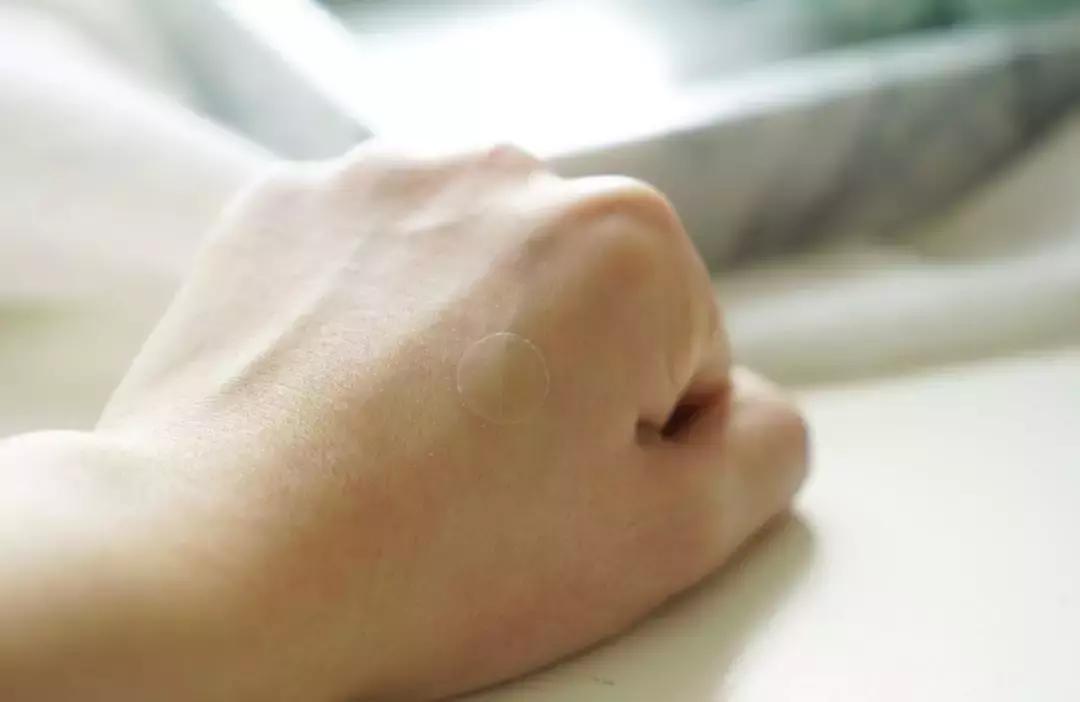 好用祛痘产品评测,抗痘最好的产品排行