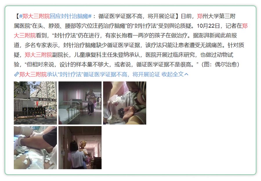 脑瘫康复的几率有多大,脑瘫超早期诊断