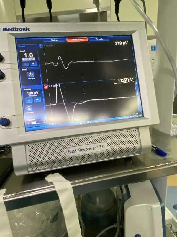 唐山市人民医院检查甲状腺,唐山市人民医院甲状腺手术