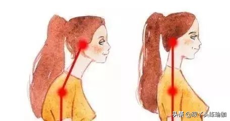 脖子前倾乌龟颈怎么办,脖子前倾乌龟脖会导致胸闷气短吗