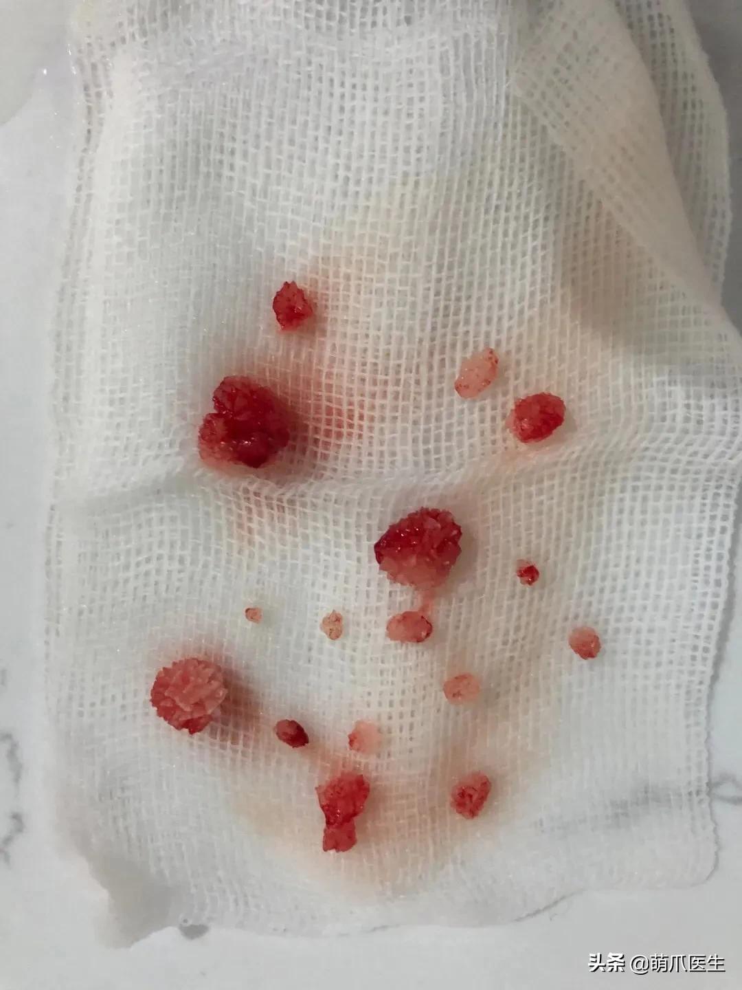 猫在被子里憋死,猫在体内就憋死了