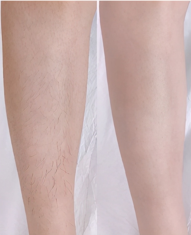 融汇丝滑脱毛慕斯使用方法,慕斯脱毛的正确使用方法步骤