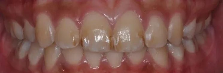 口腔牙医感言,牙医从业感悟