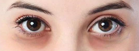 孕期可以使用兰蔻菁纯眼霜吗,孕期眼霜大牌推荐