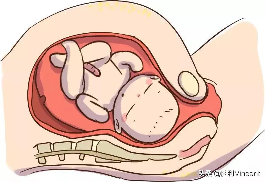 盆底肌腹直肌和骨盆修复哪个重要,了解盆底