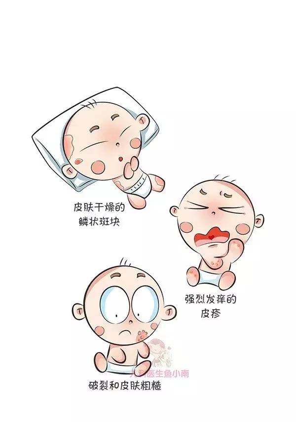 荨麻疹湿疹发病原因及治疗方法,热疹皮疹湿疹有什么区别