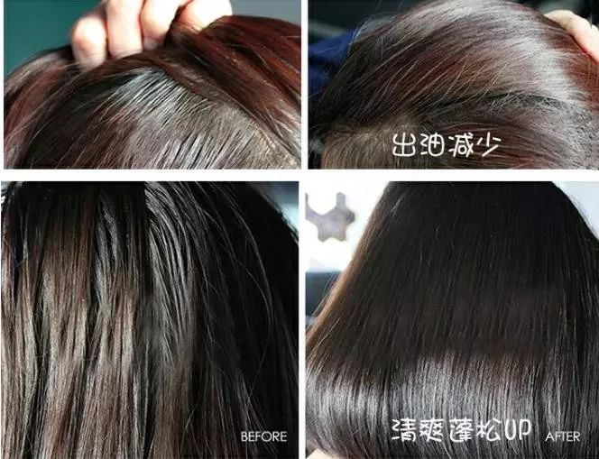清爽头皮不掉发洗发露,秃头油腻头屑多洗发水推荐