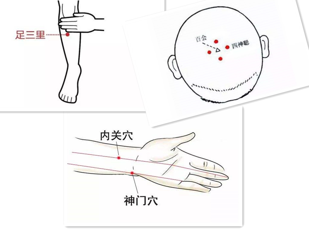 我的天呀！得了神经衰弱，这里有治疗方法哟——宏世堂干货分享