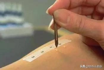 治螨的最好方法,怎样除螨避免过敏