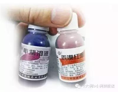 如果衣服上有脏东西应该怎么洗掉,衣服染上黄渍怎么洗掉