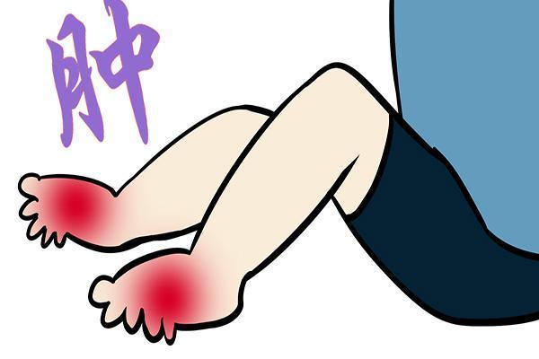 刮痧有什么技巧变红,刮痧只是刮红了起作用吗