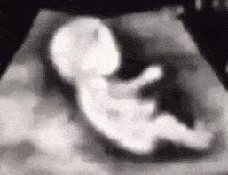 一般怀孕几个月可以感受到胎动,孕妇几个月开始有胎动什么感觉