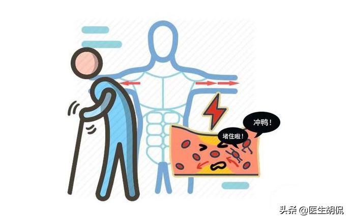 没事看看手，手掌一个特征，或暗示体内有栓！做好3点，冲走血栓