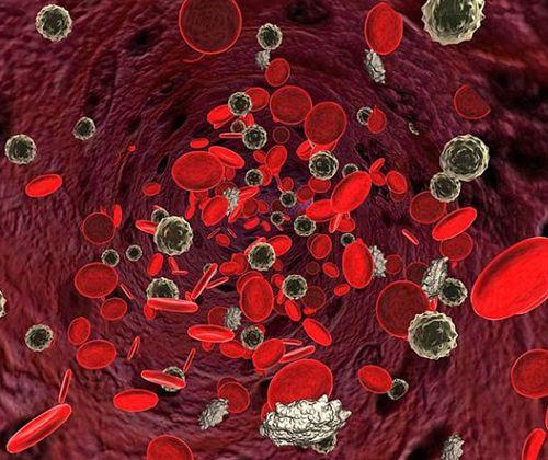 癌症怎么转移的,癌症是如何转移的