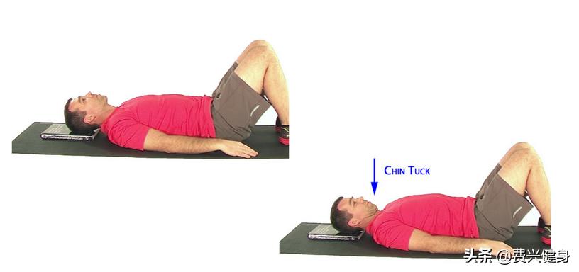 调理上交叉综合征动作,交叉综合症矫正方法