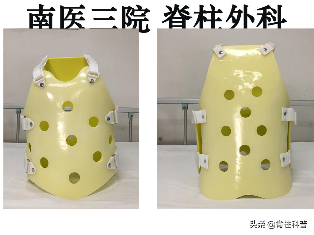 峡部裂导致的滑脱是不是必须手术,峡部裂保守治疗的方式有哪些