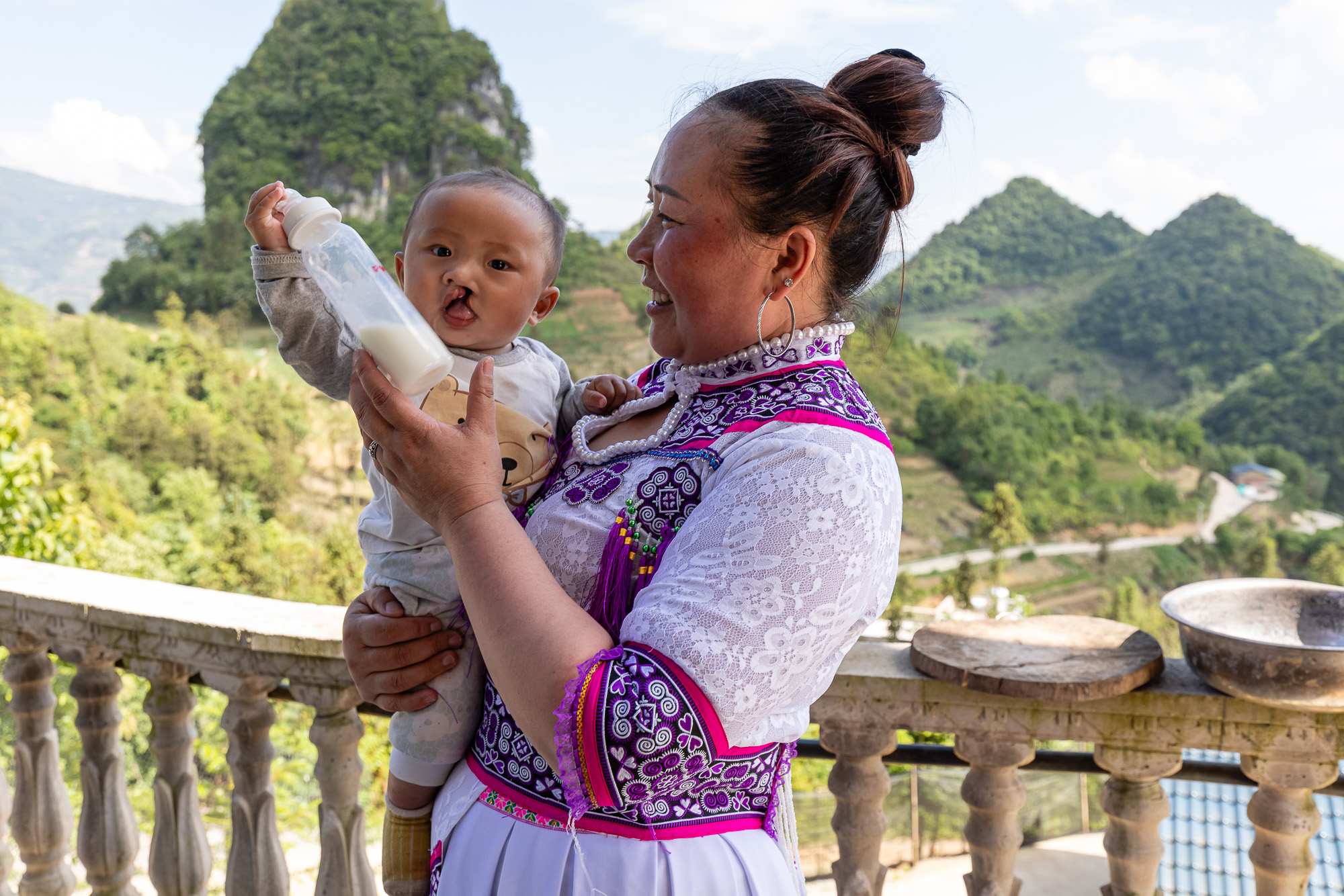 贝亲牵手“微笑行动”，只为唇腭裂宝宝那抹微笑