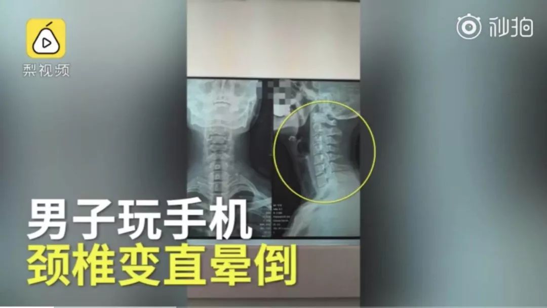 低头玩手机如何缓解颈椎,你还在侧躺玩手机吗