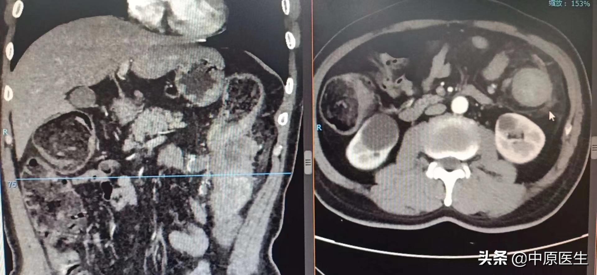 手术室没想象中的那么可怕,手术室没有想象的那么可怕