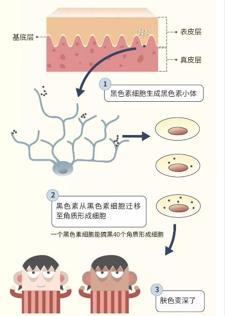 怎么判断是不是兽皮痣,兽皮痣怎么造成的能根治吗