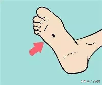 有黑痣不要慌教你一招,黑痣出现10个危害大