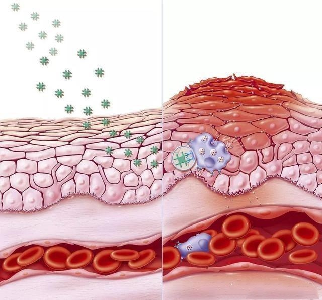 皮肤瘙痒要不要挠,皮肤瘙痒的让人抓狂10种止痒妙方