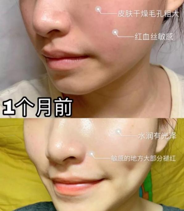 这面霜好用不踩雷，用过的都说好，让你做完美无瑕的瓷肌美人