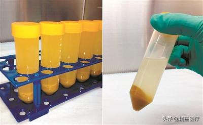90%的肠道疾病治愈率!知道这颗药成分的我,哭了