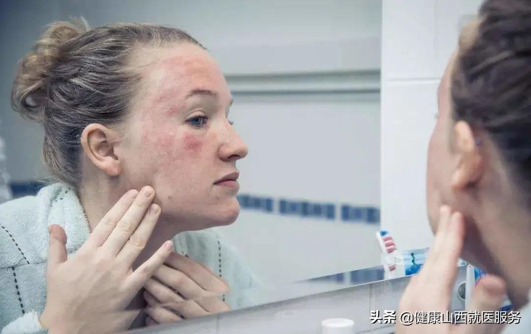 男生皮肤干燥怎么补水保湿,皮肤干燥怎么补水保湿化妆