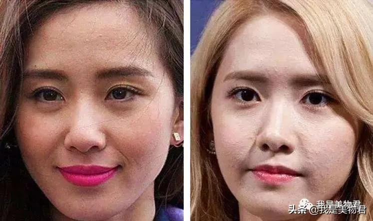 痘痘肌用什么医美面膜,医美面膜测评痘痘肌