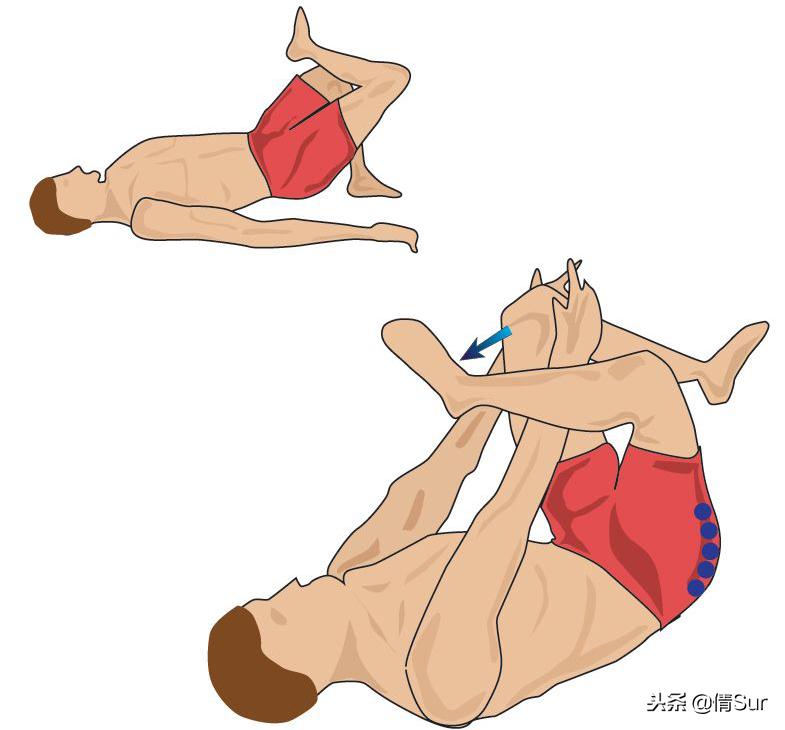 腰肌劳损导致后背痛怎么办,腰肌劳损加重了怎么办