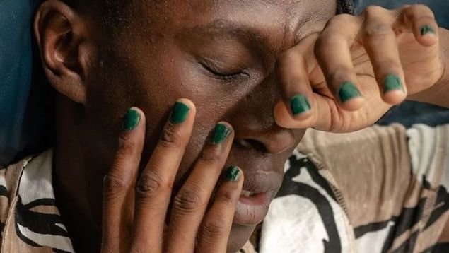 男生想变帅其实真不难,男生想整容正常吗