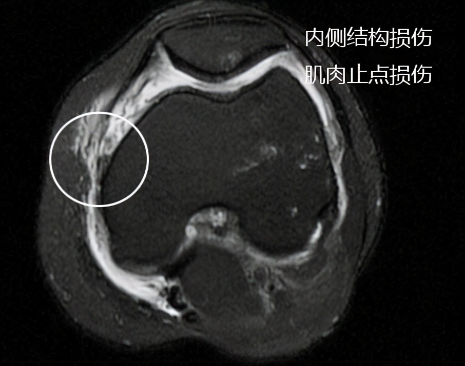 到底是手术好还是保守治疗好,保守治疗和手术治疗怎么选