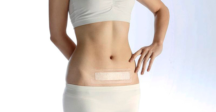 剖腹产伤口如何才能更快恢复,剖腹产伤口该注意哪些