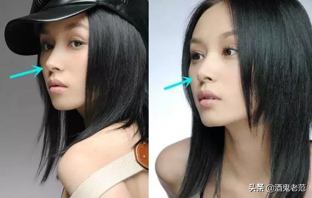 整容成小三,整容变美却嫁给丑八怪