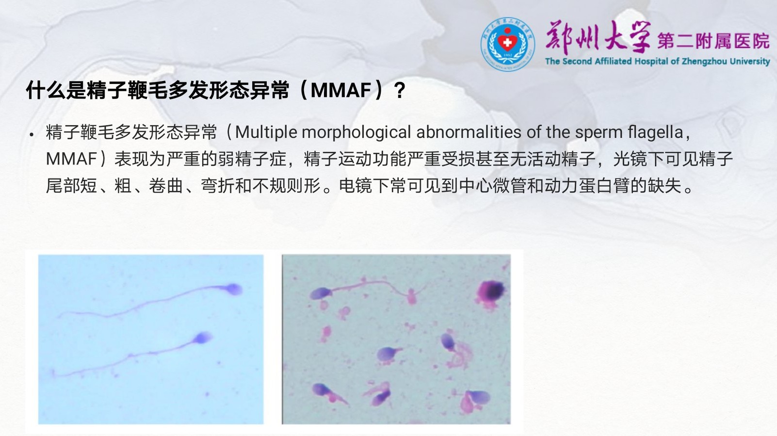 严重弱精症和完全无活动精子的原因是啥？