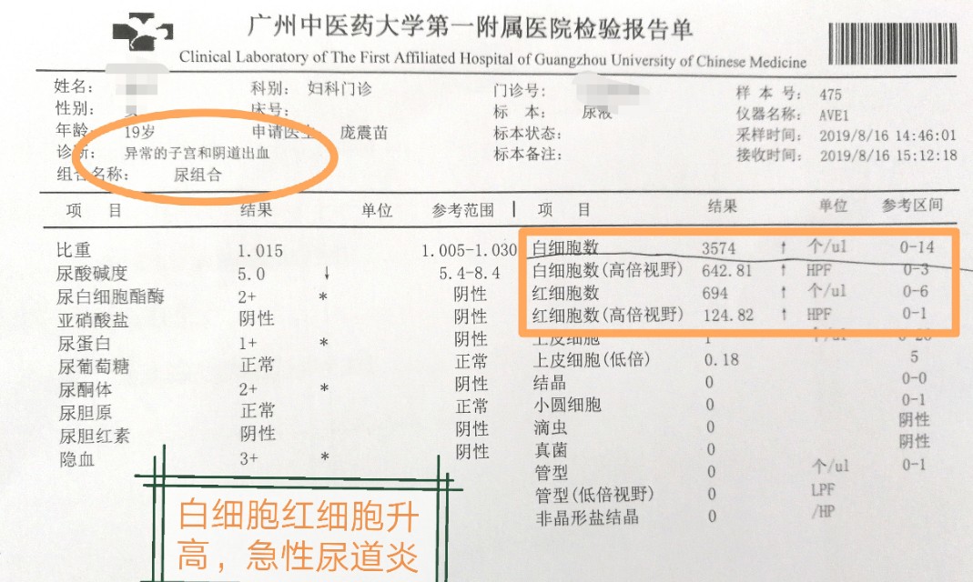 昨晚跟男朋友爱爱后尿痛怎么办？